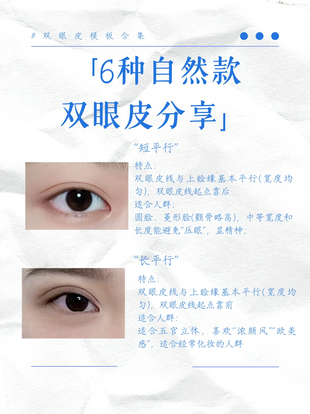 三种常见双眼皮款式细分！