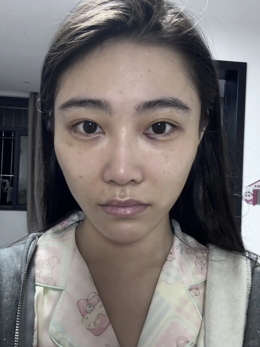 医美do脸对比照来喽