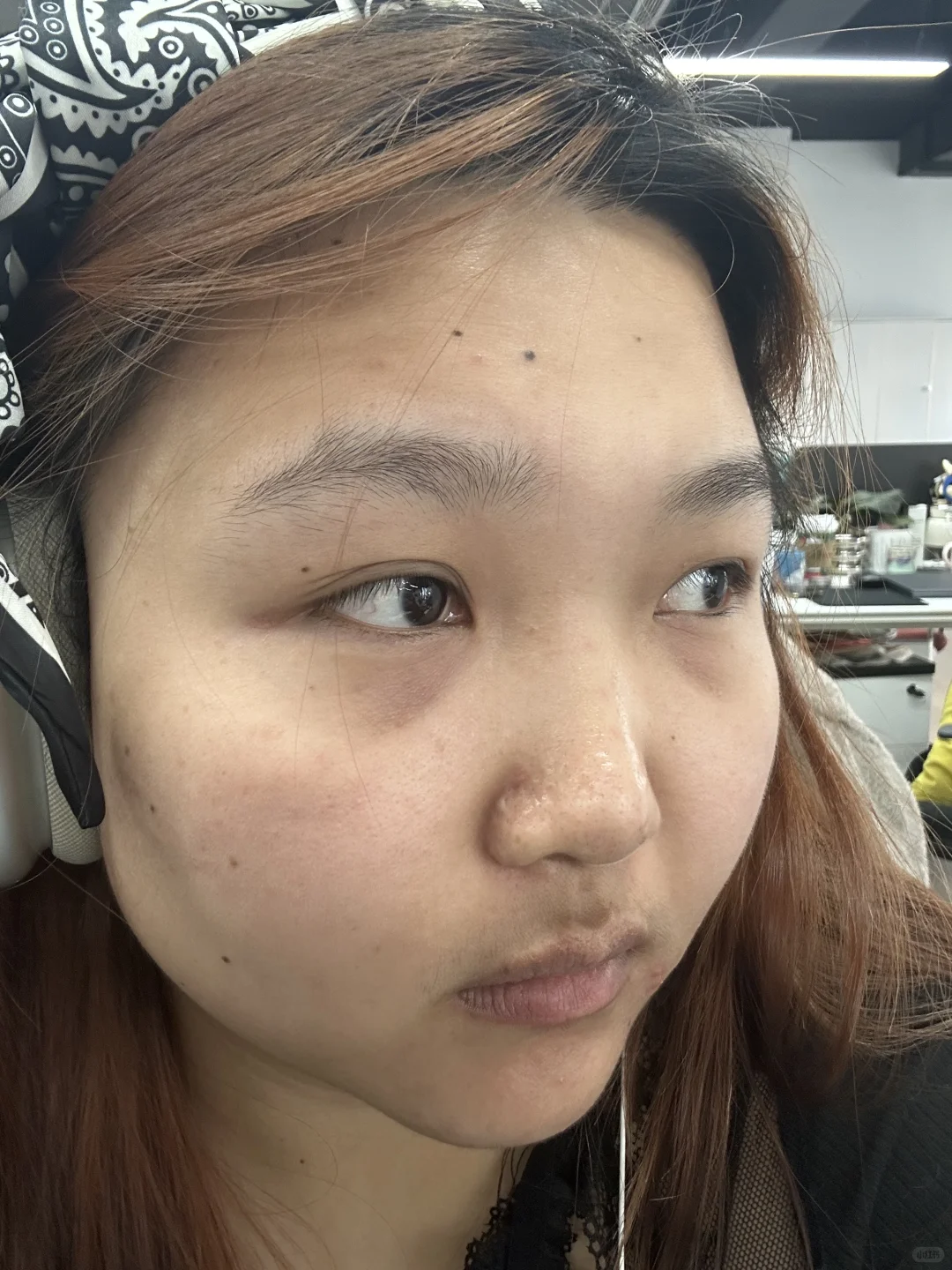 明天就要躺上冰冷冷的手术台了….