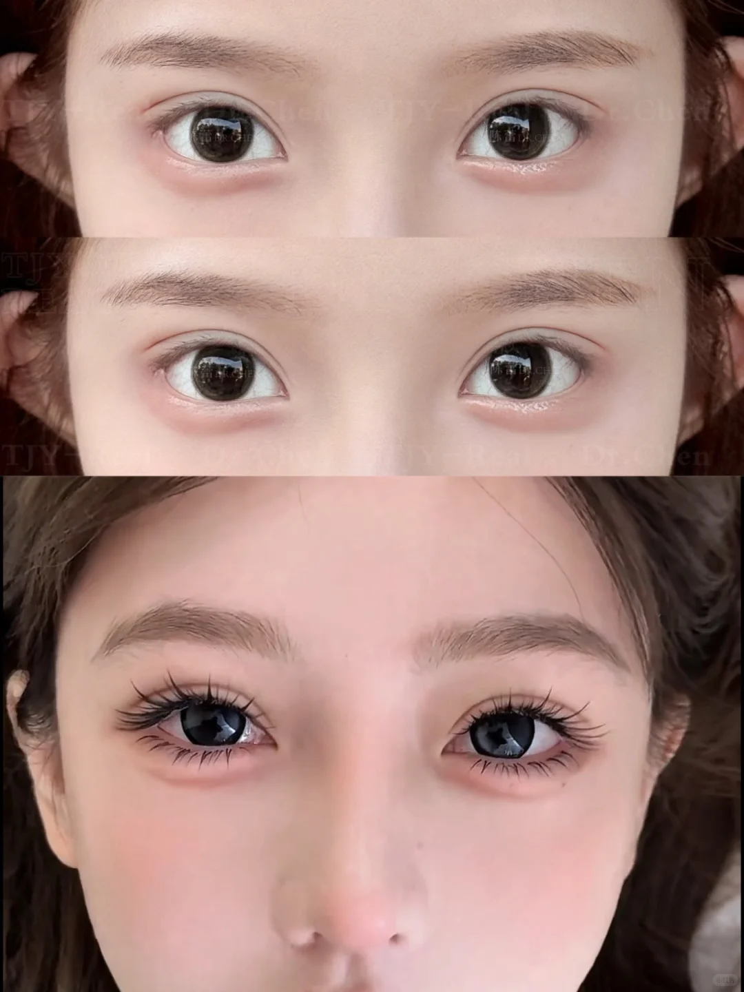 漫画款双眼皮｜7.8mm素颜也美❕