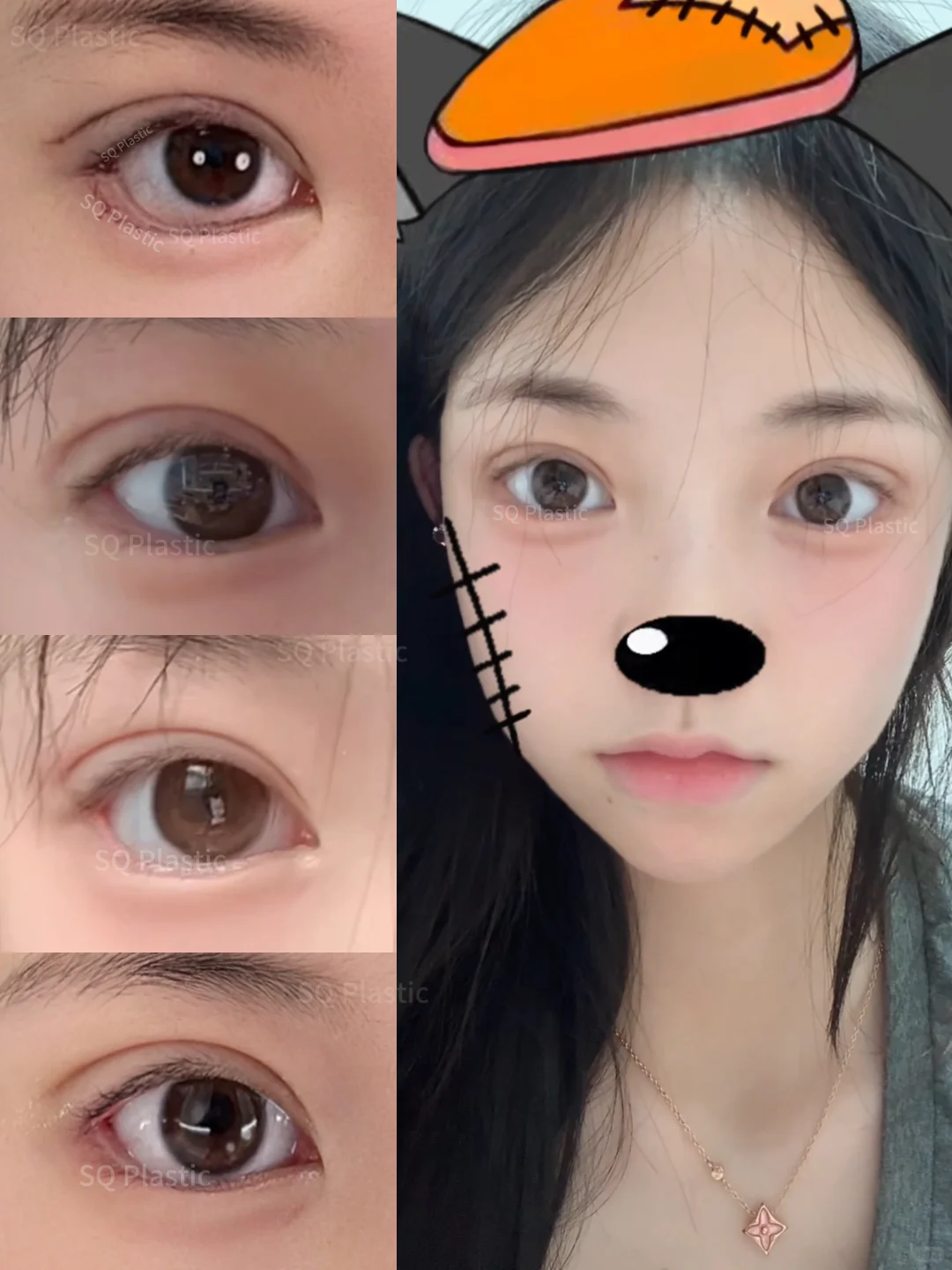 听我的‼️喜欢幼态就选平开扇➕圆眼