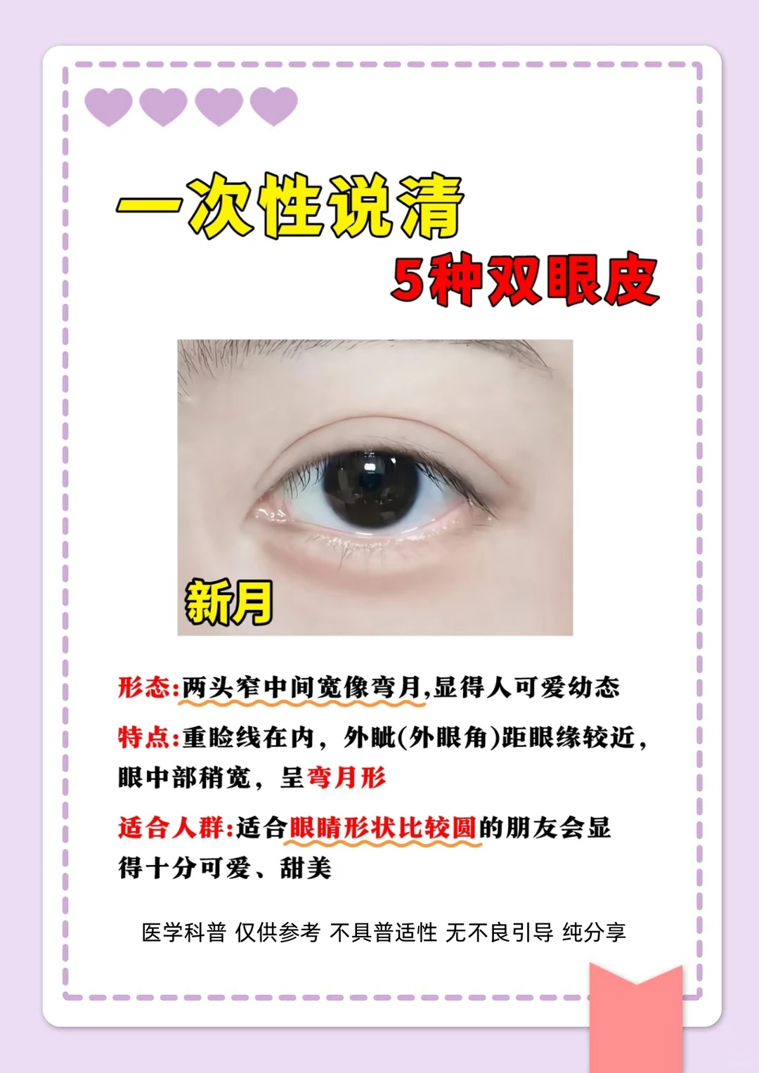 整形主任讲科普，5种双眼皮形态一次性说清楚