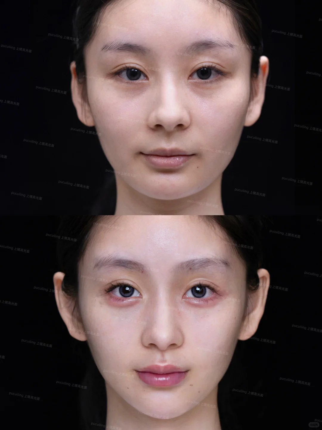 高颧骨+疲态脸|微调逆袭上镜脸