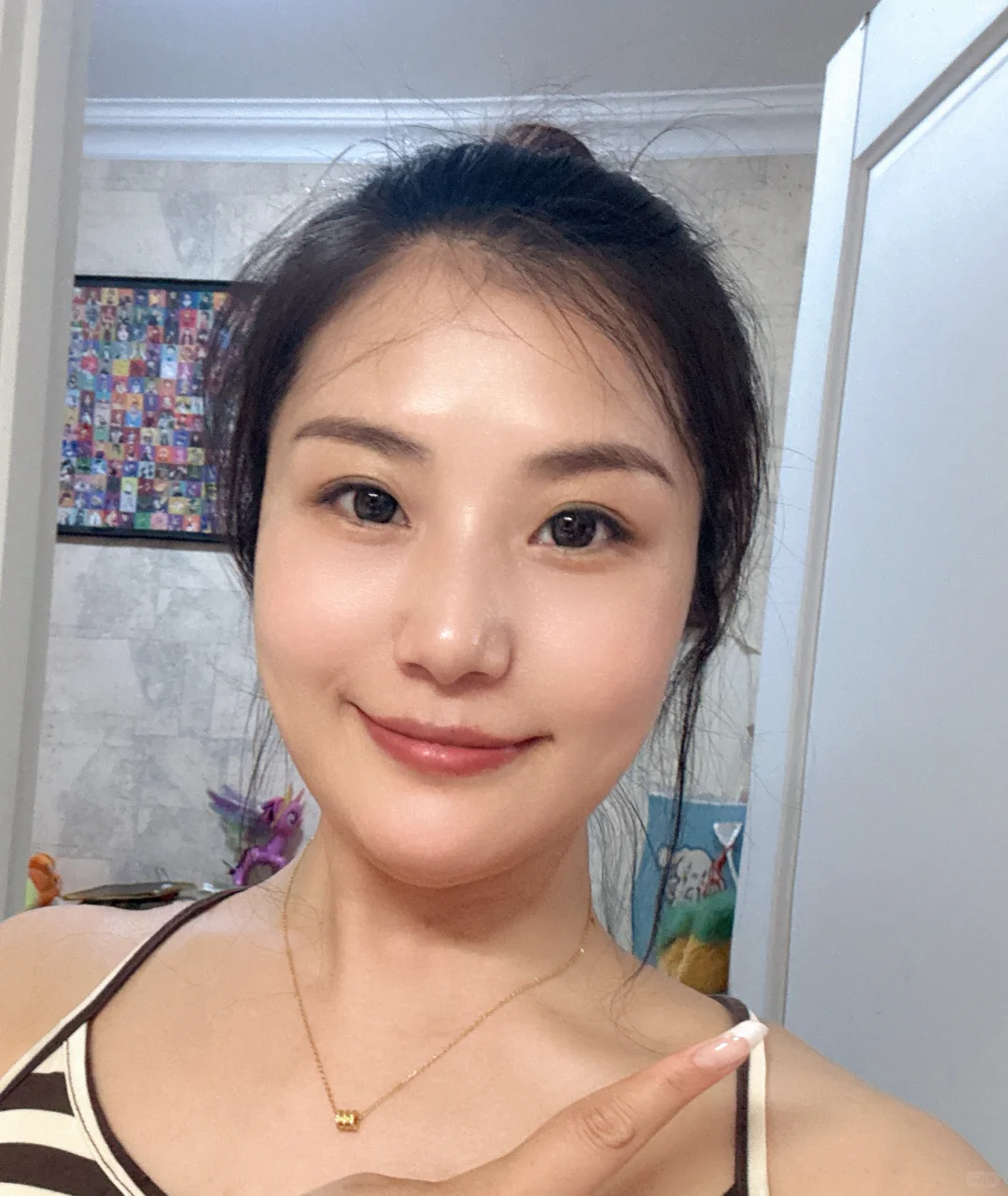 西安35＋职场宝妈首次注射太阳穴恢复情况