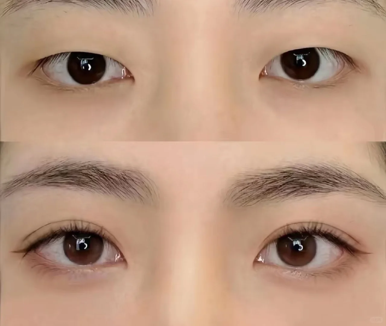 挣点钱全花脸上来啦🥹🥹🥹不过变美就是值得