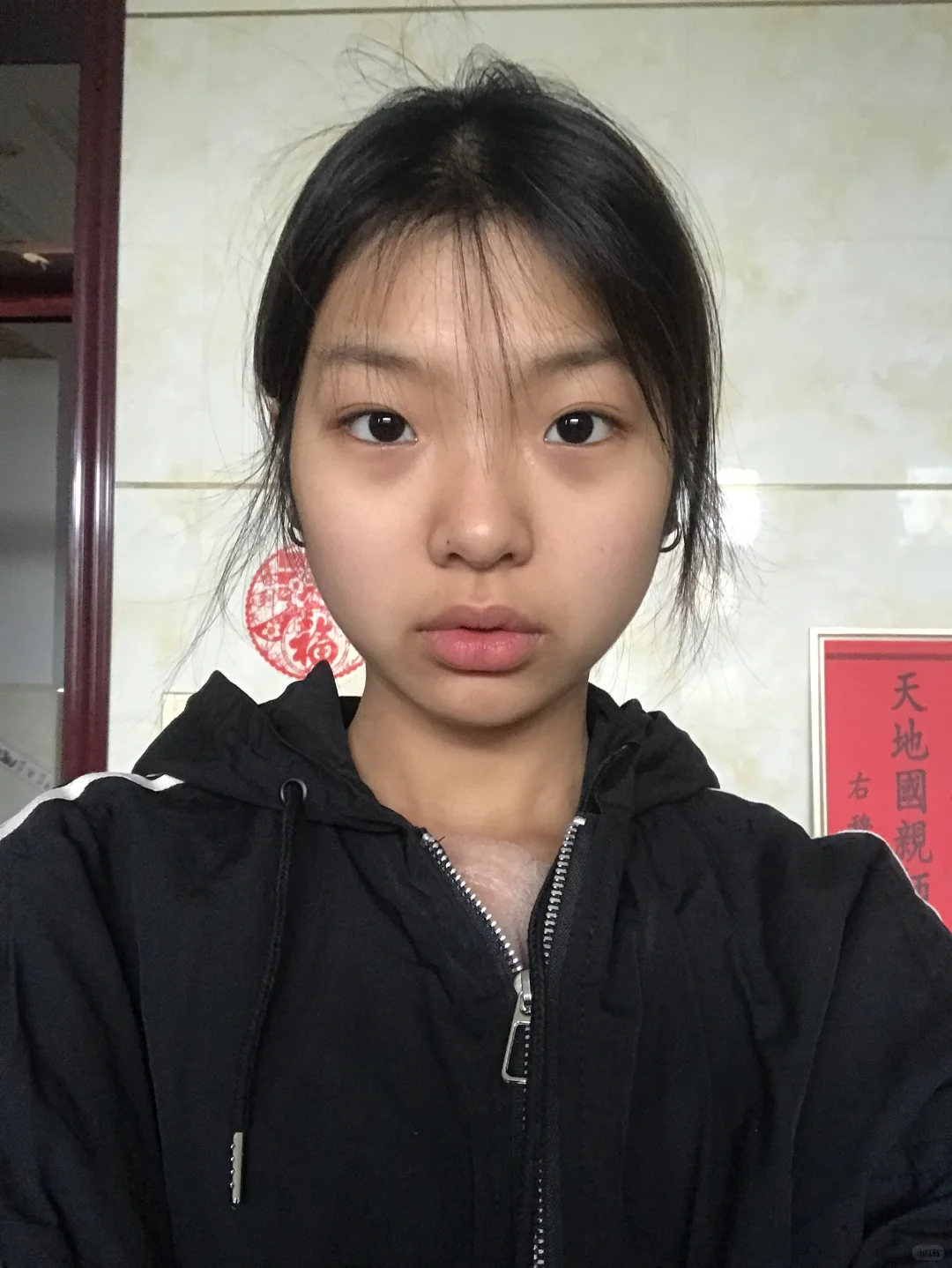 真心听劝 求低成本无广变白方法