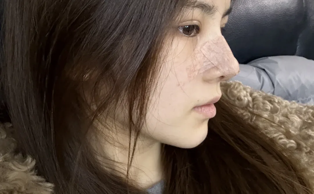 do鼻👃🏻14天噜