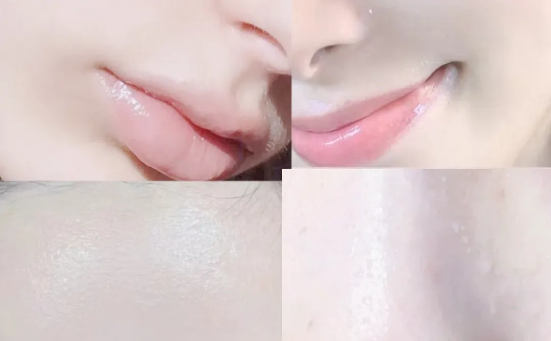 💐天啊 我的皮肤怎么那么好