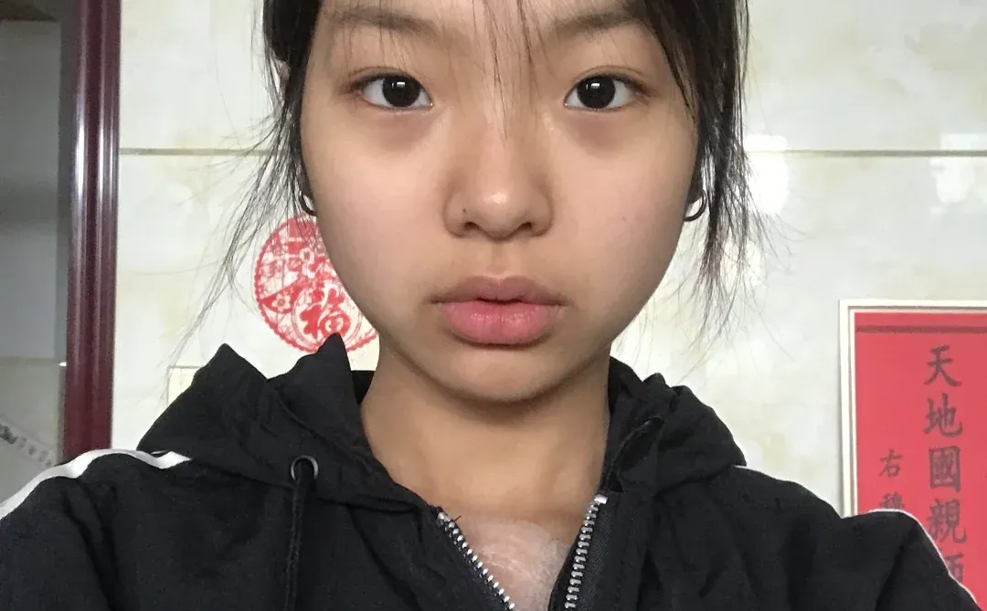 真心听劝 求低成本无广变白方法