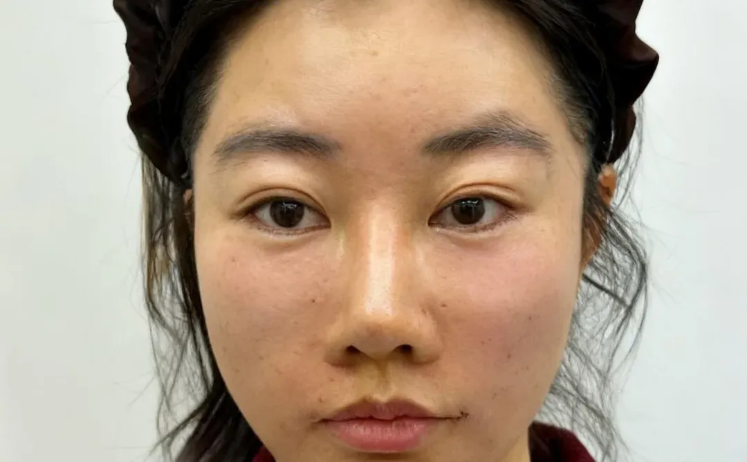 去微调了，2个，有变成小美吗