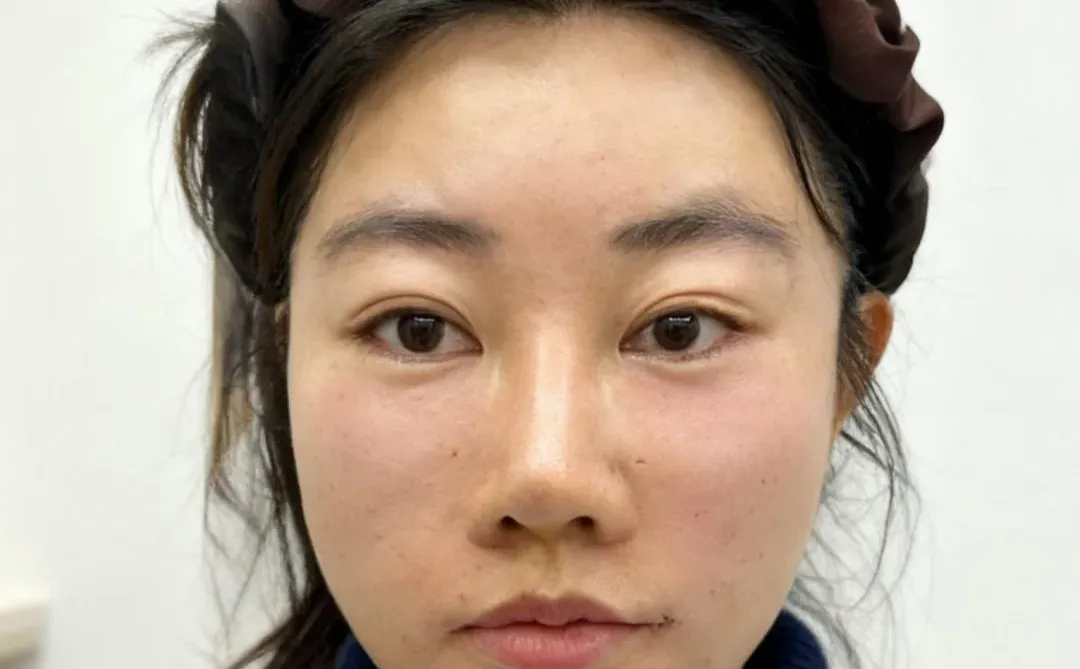 微调了，2W，有变成小美吗