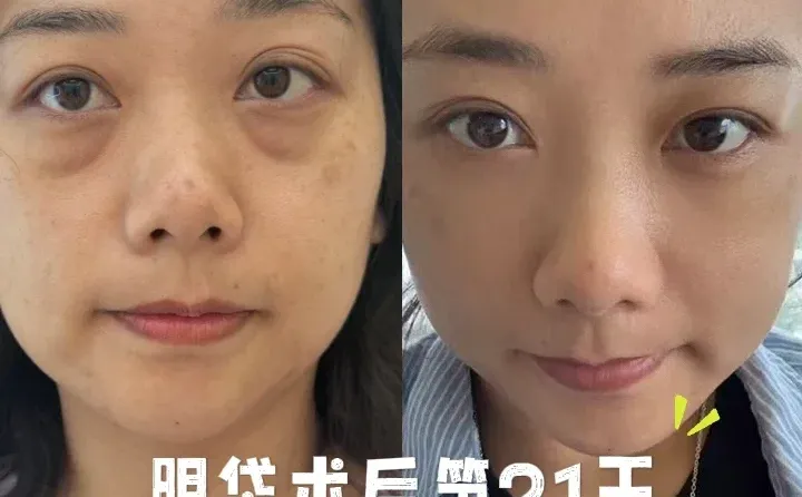 普通人噶眼袋第21天，太值了！