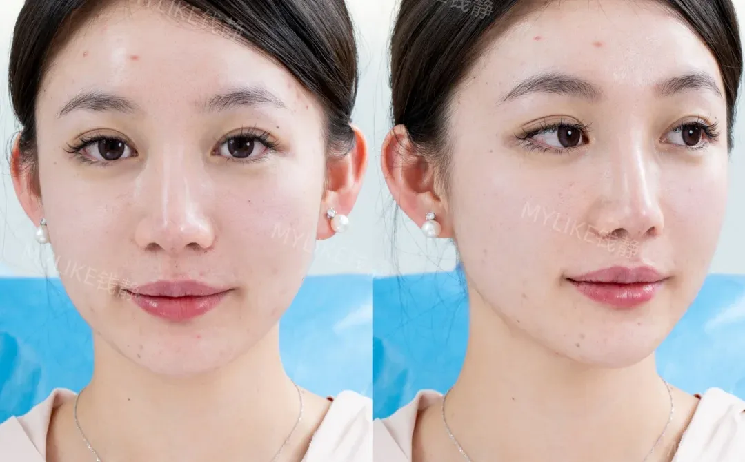 给昆明微调界 亿点点震撼～