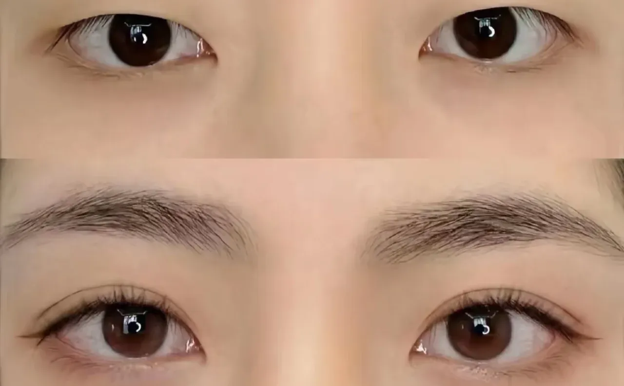 挣点钱全花脸上来啦🥹🥹🥹不过变美就是值得