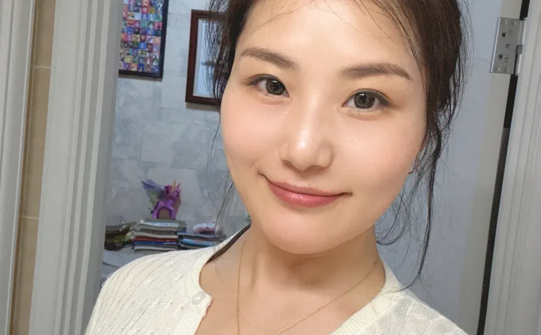 西安35＋职场宝妈首次注射太阳穴恢复情况