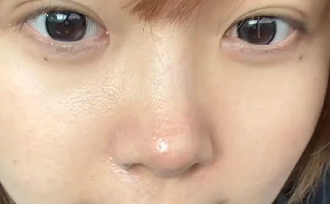 轻薄脸live图，这个眼周提升绝了！