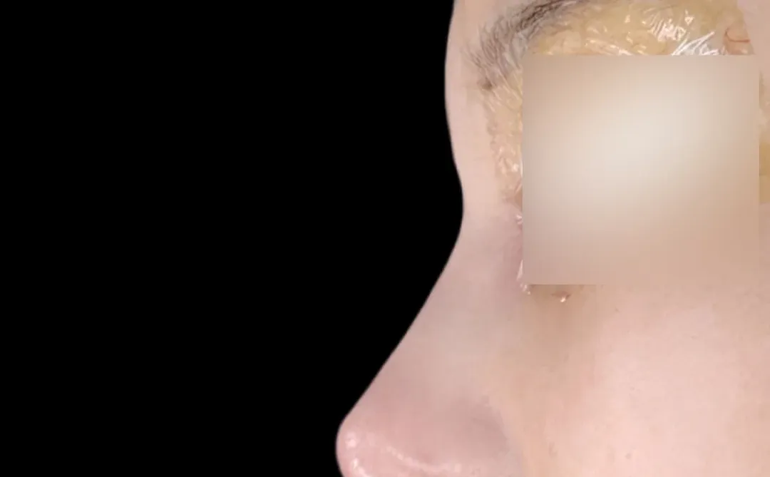 直鼻微翘自然款，不夸张，妈生感