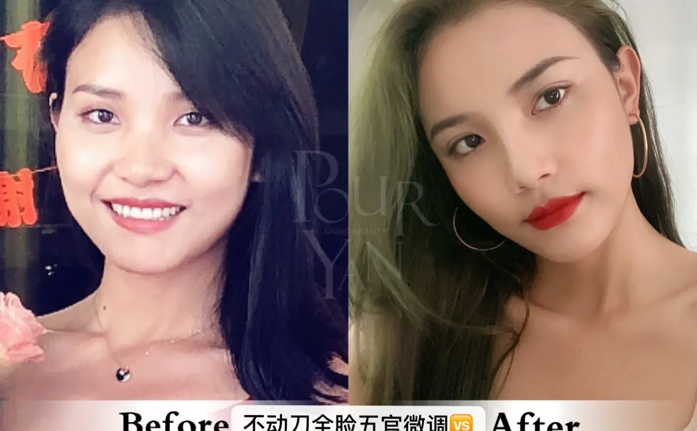 全脸都do了‼️但❓告诉我真的变好看了吗⁉️