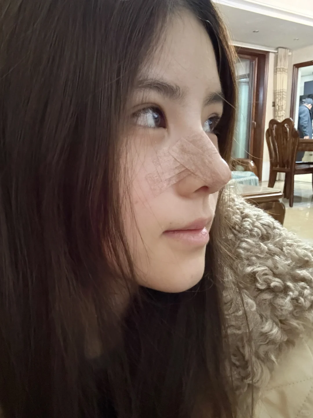 do鼻👃🏻14天噜