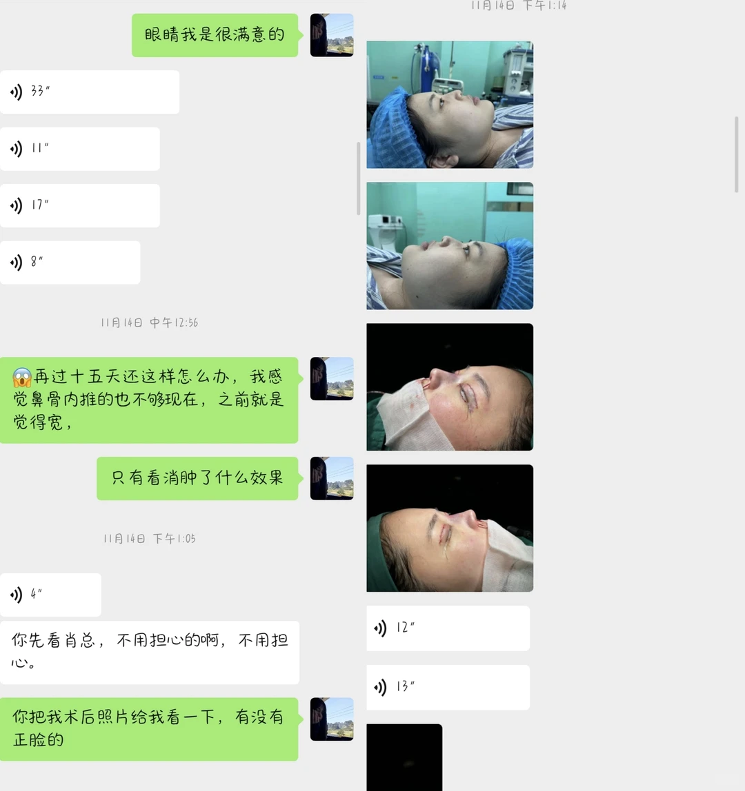 鼻子做成这样还跟我说我要求高