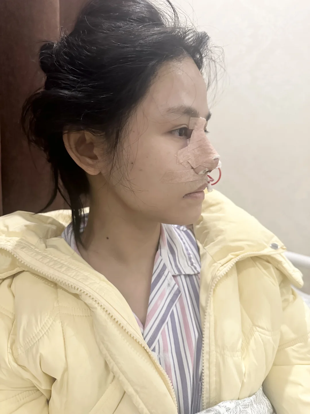 我要一个妈生鼻！