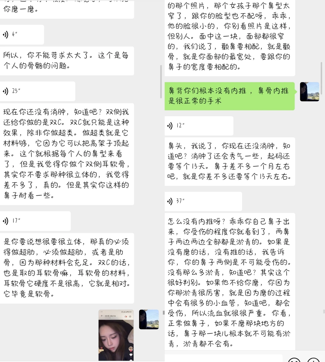 鼻子做成这样还跟我说我要求高