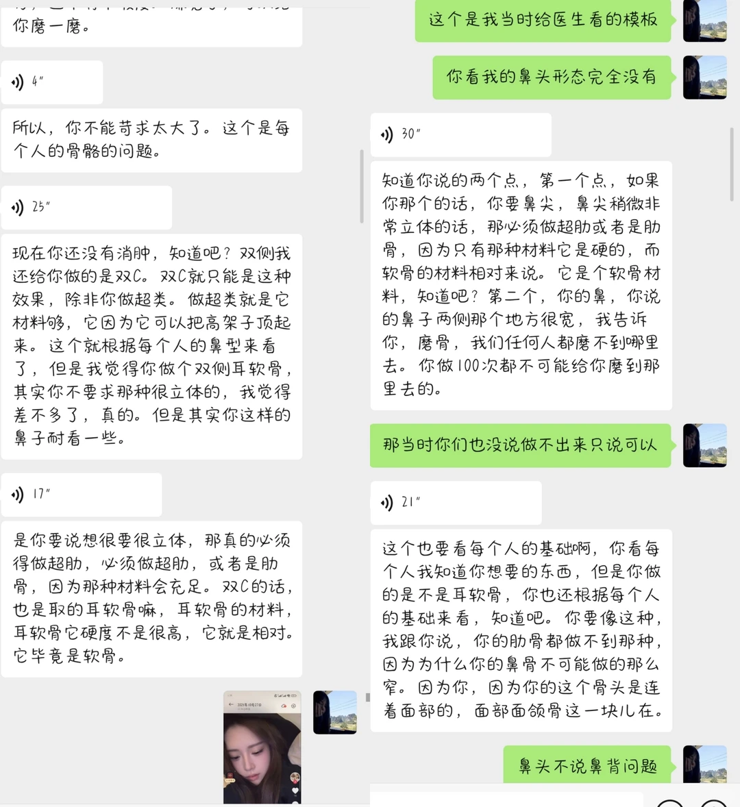 鼻子做成这样还跟我说我要求高