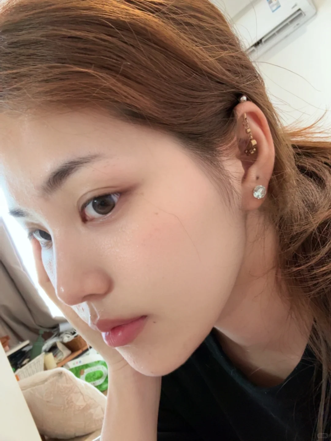 两年三次成都注射鼻子，已经没耐心了。。。