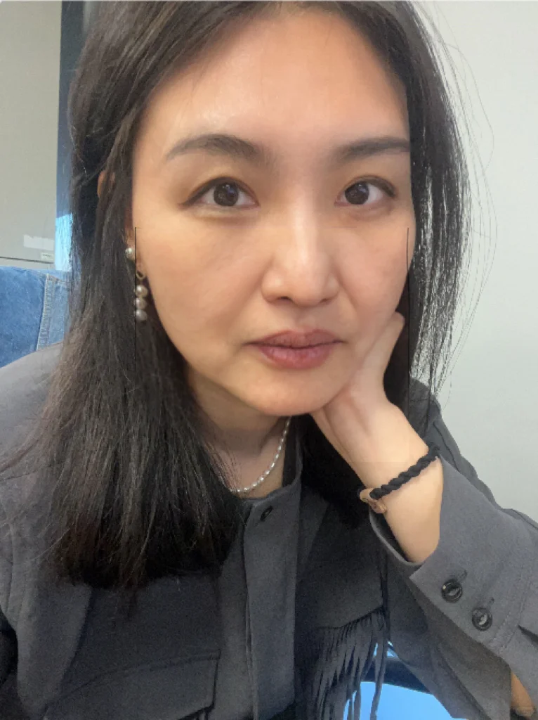 皮贴骨，内窥镜小切口筋膜提升1个月