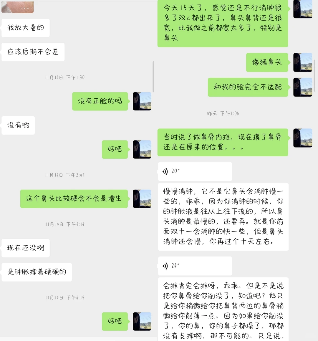 鼻子做成这样还跟我说我要求高