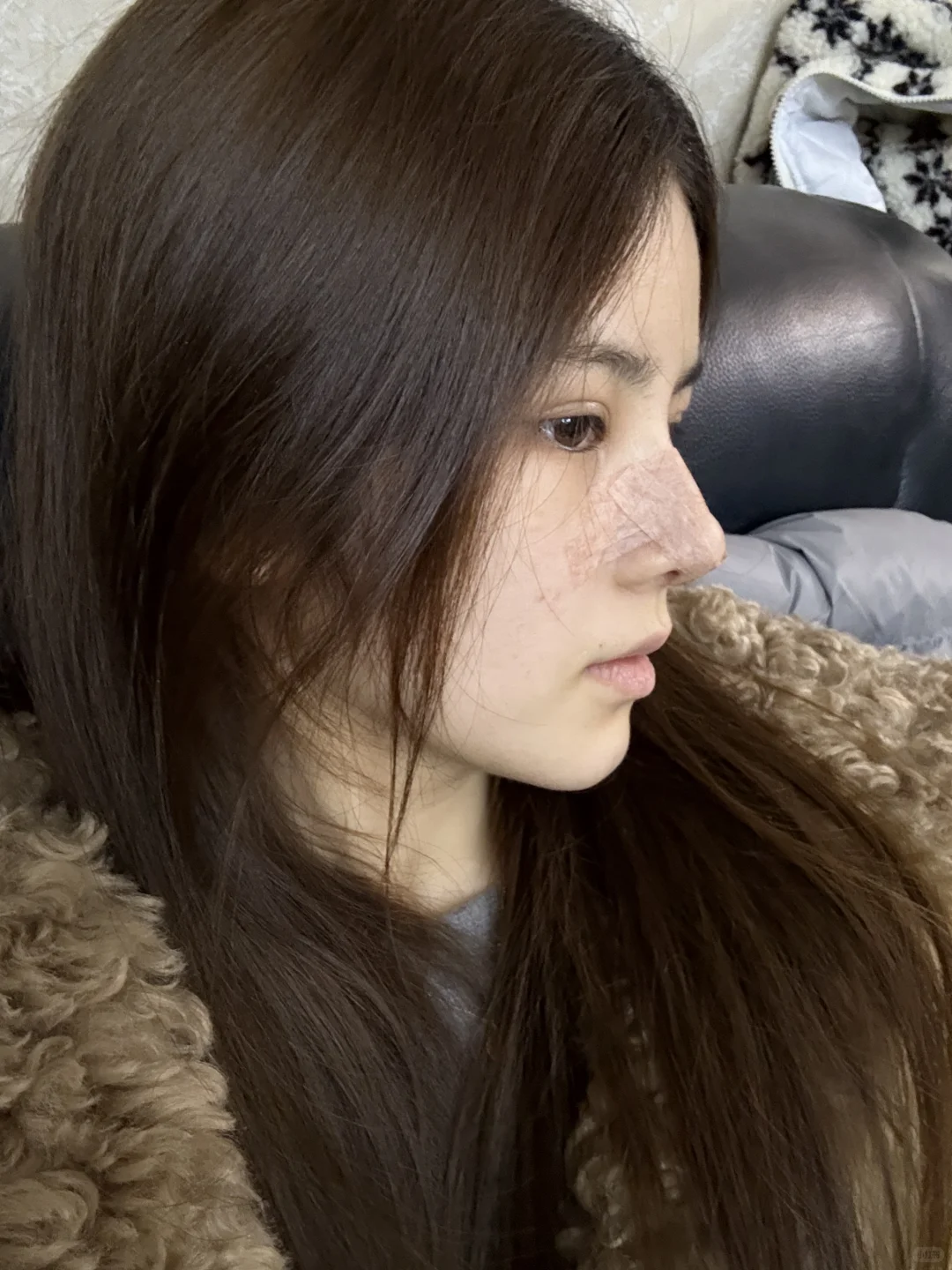 do鼻👃🏻14天噜