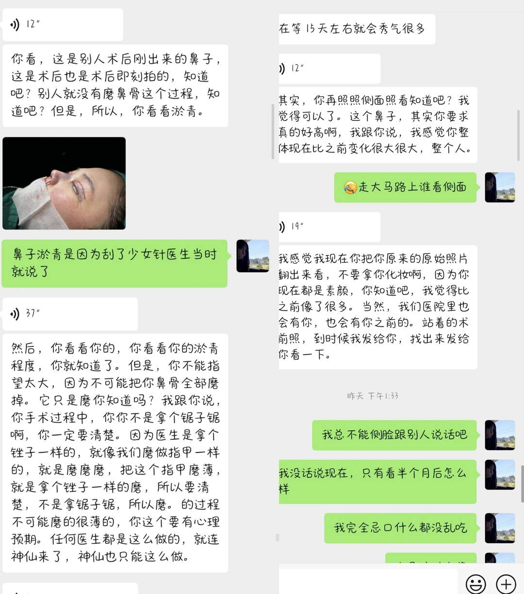 鼻子做成这样还跟我说我要求高