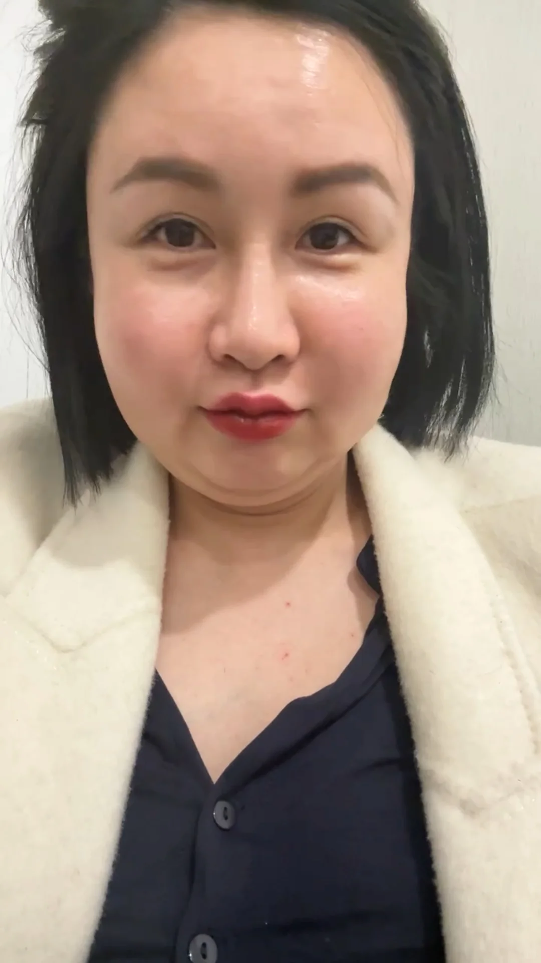 20支ZS填充物毁了我的脸