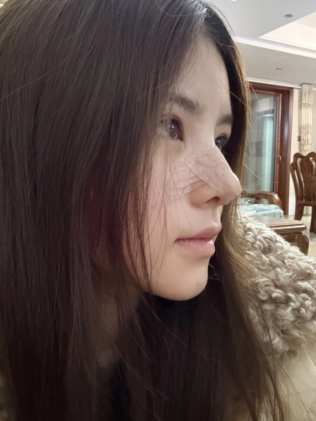 do鼻👃🏻14天噜