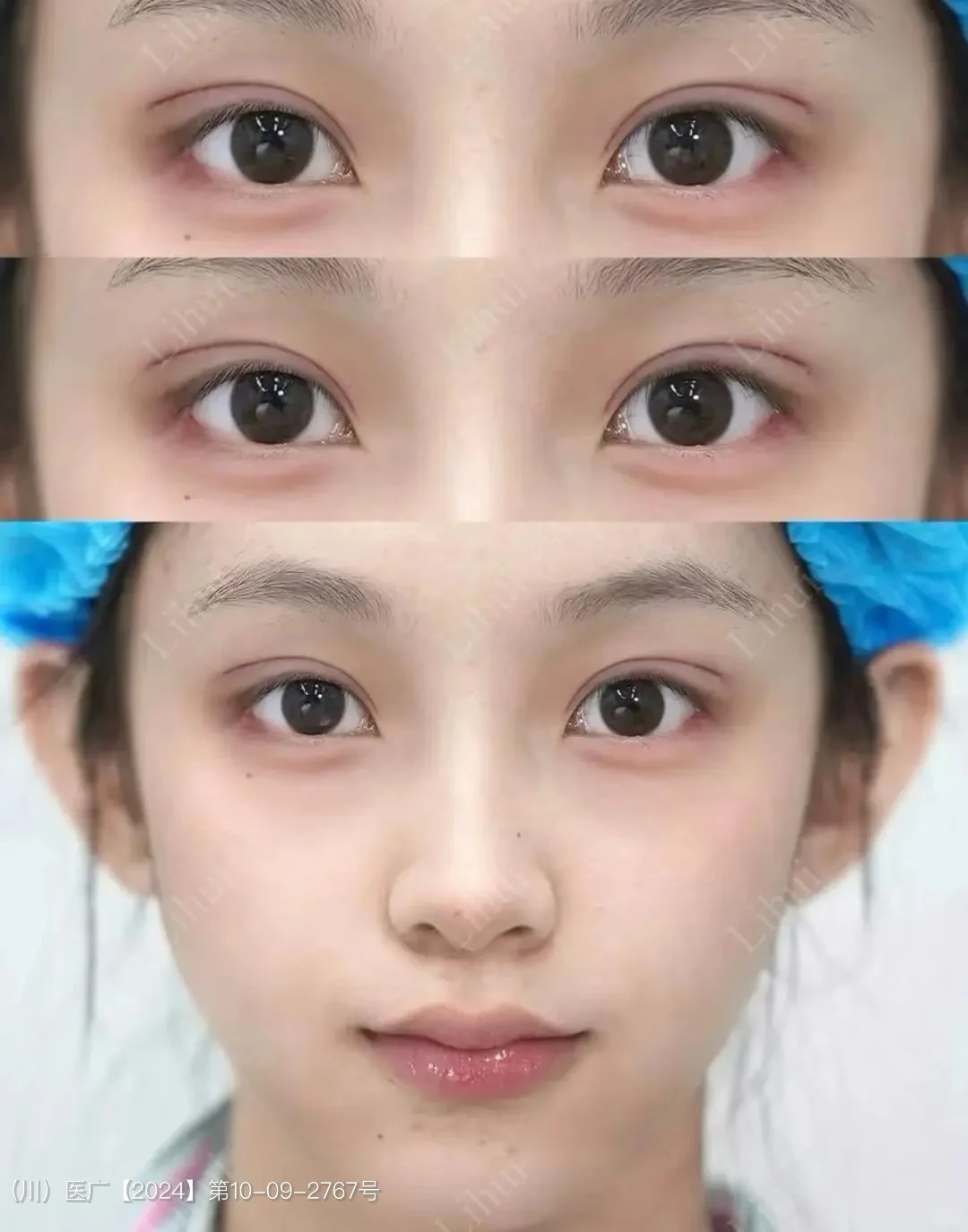 眼尾上扬➕饱满卧蚕｜幼态媚眼get ✨
