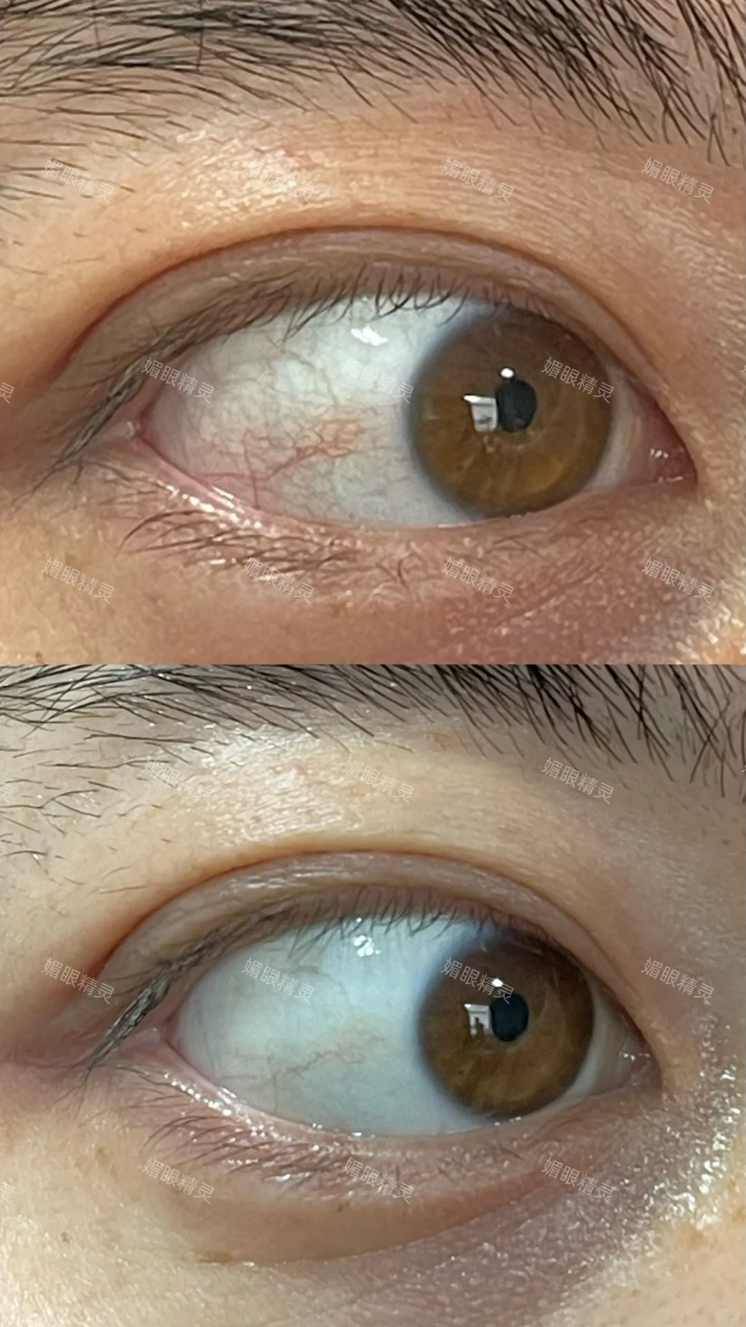 你的眼睛累了吗？