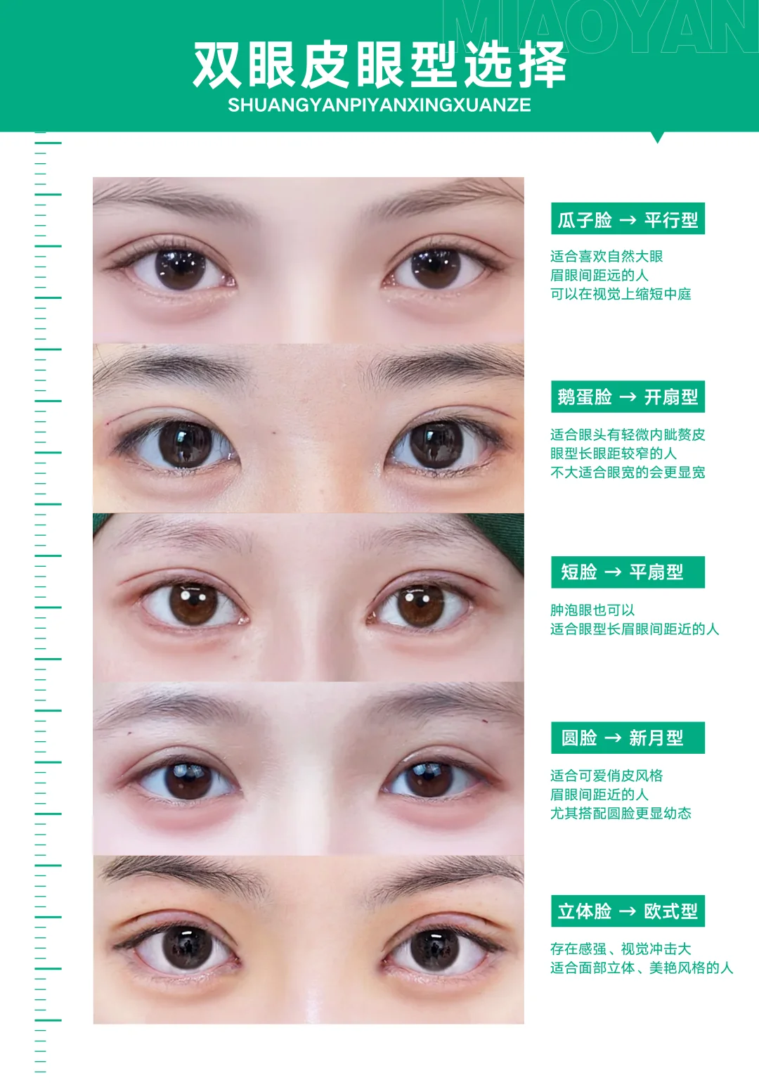 5种高吸引力眼型，快速自测！