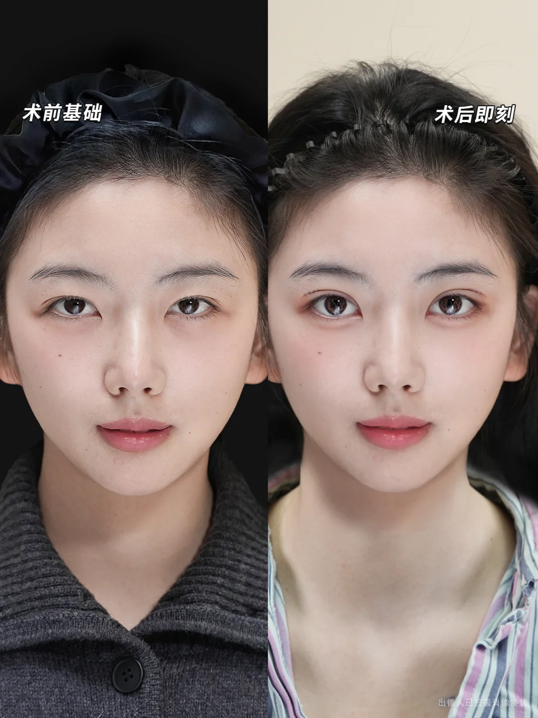 快看！6.8mm狐系平扇➕幼态卧蚕真的绝了