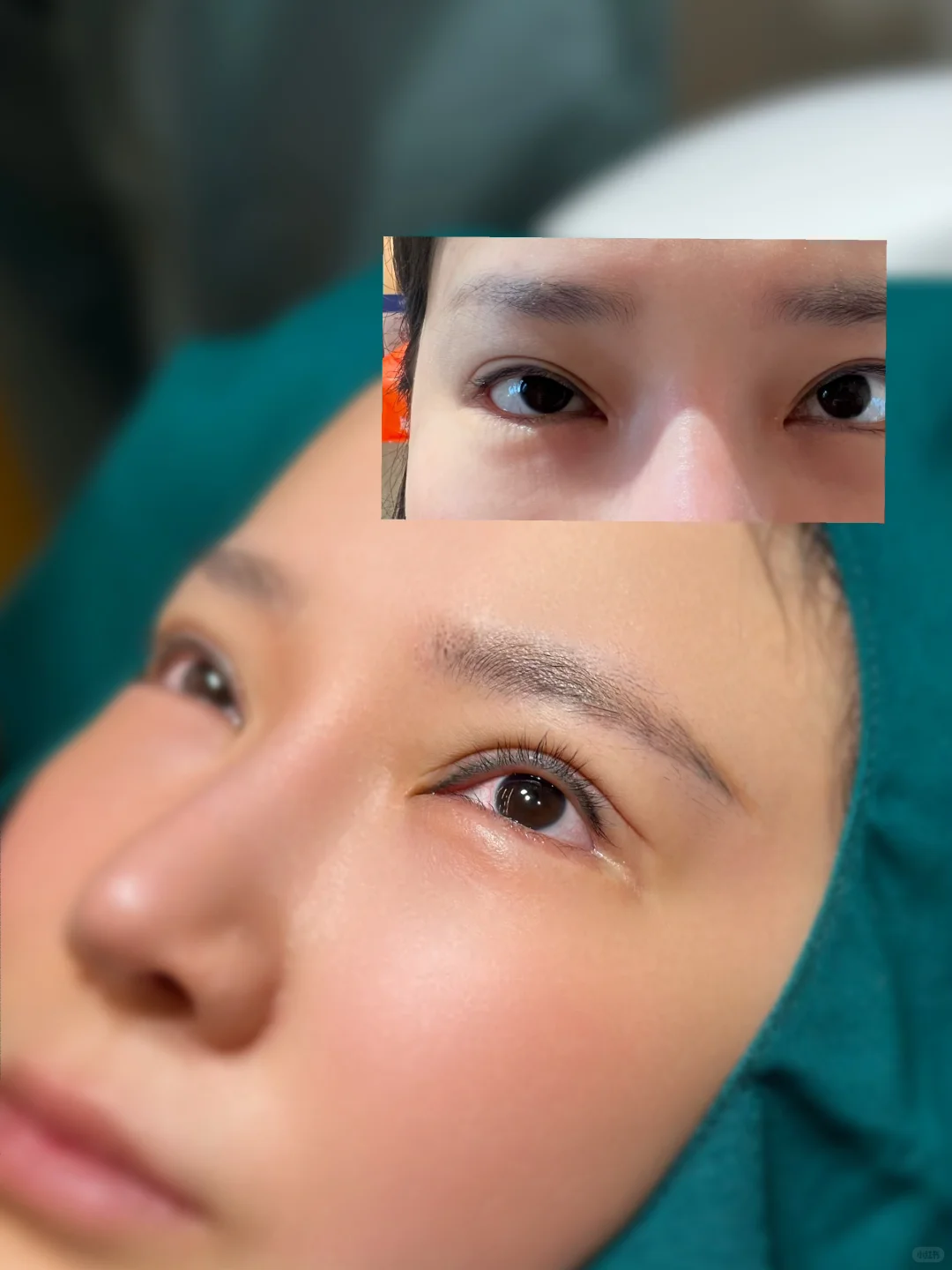 3D无痕