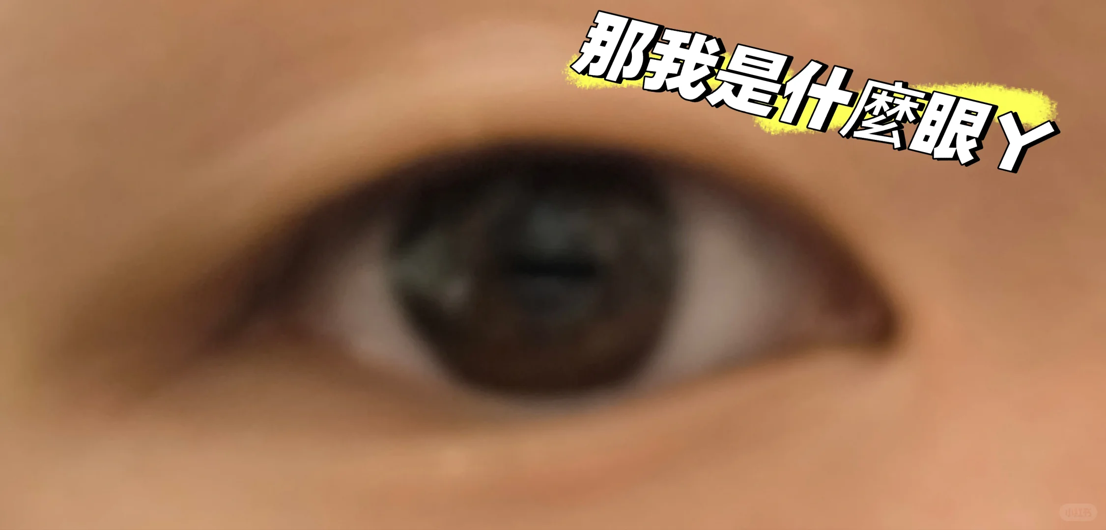 眼睛