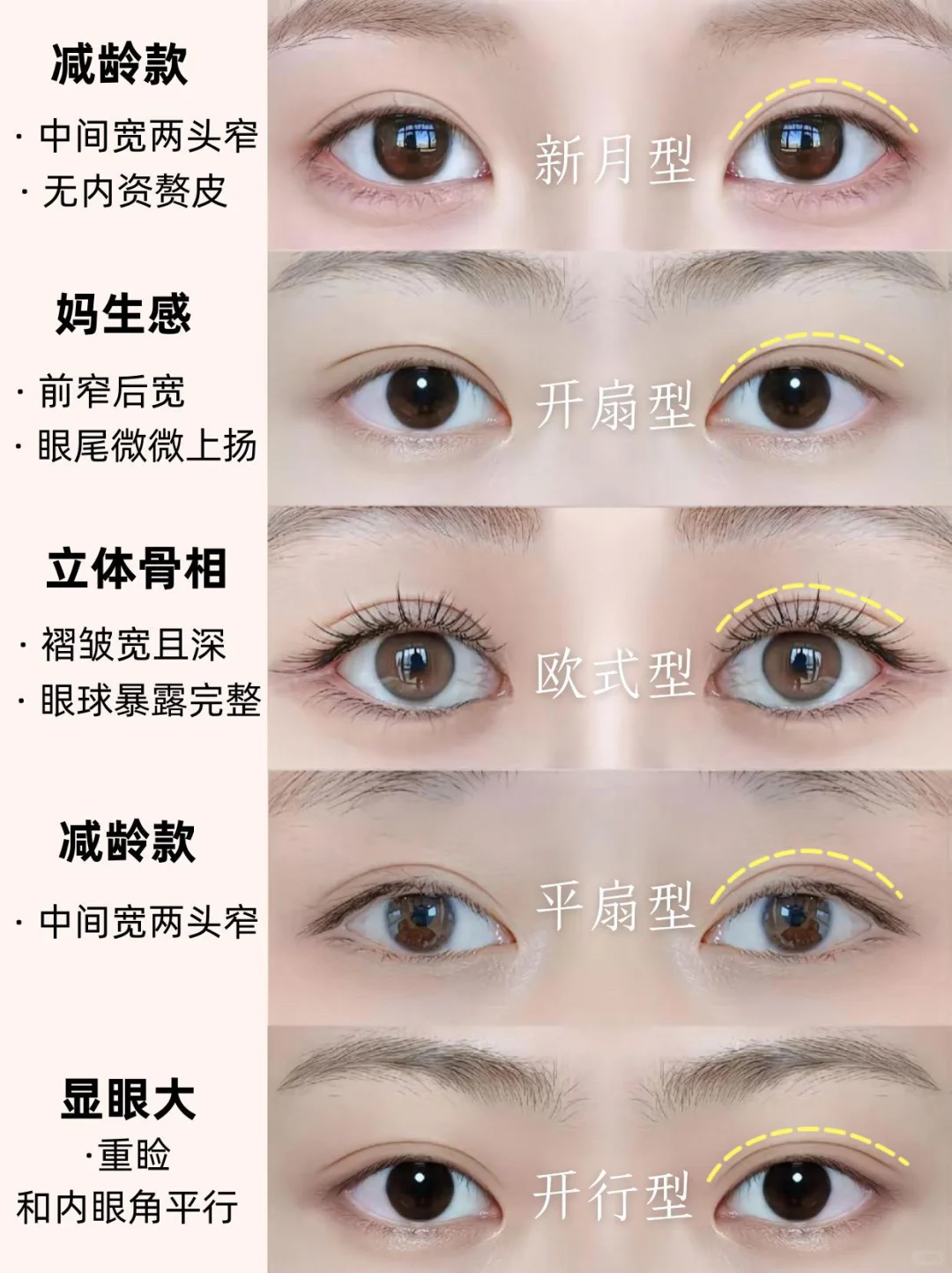 双眼皮怎么选？看这里！