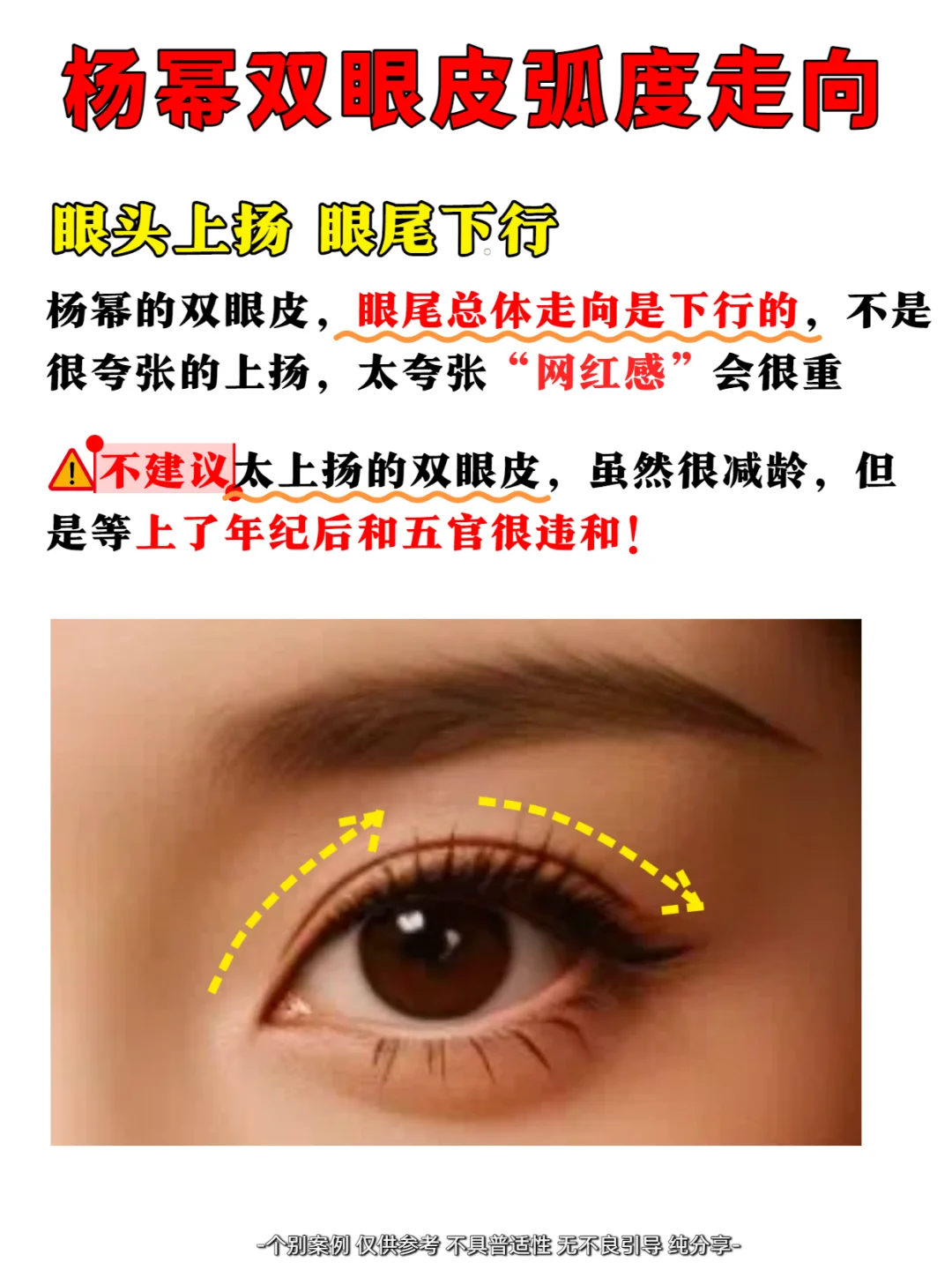 怎么没人拿杨幂的双眼皮当模板❓