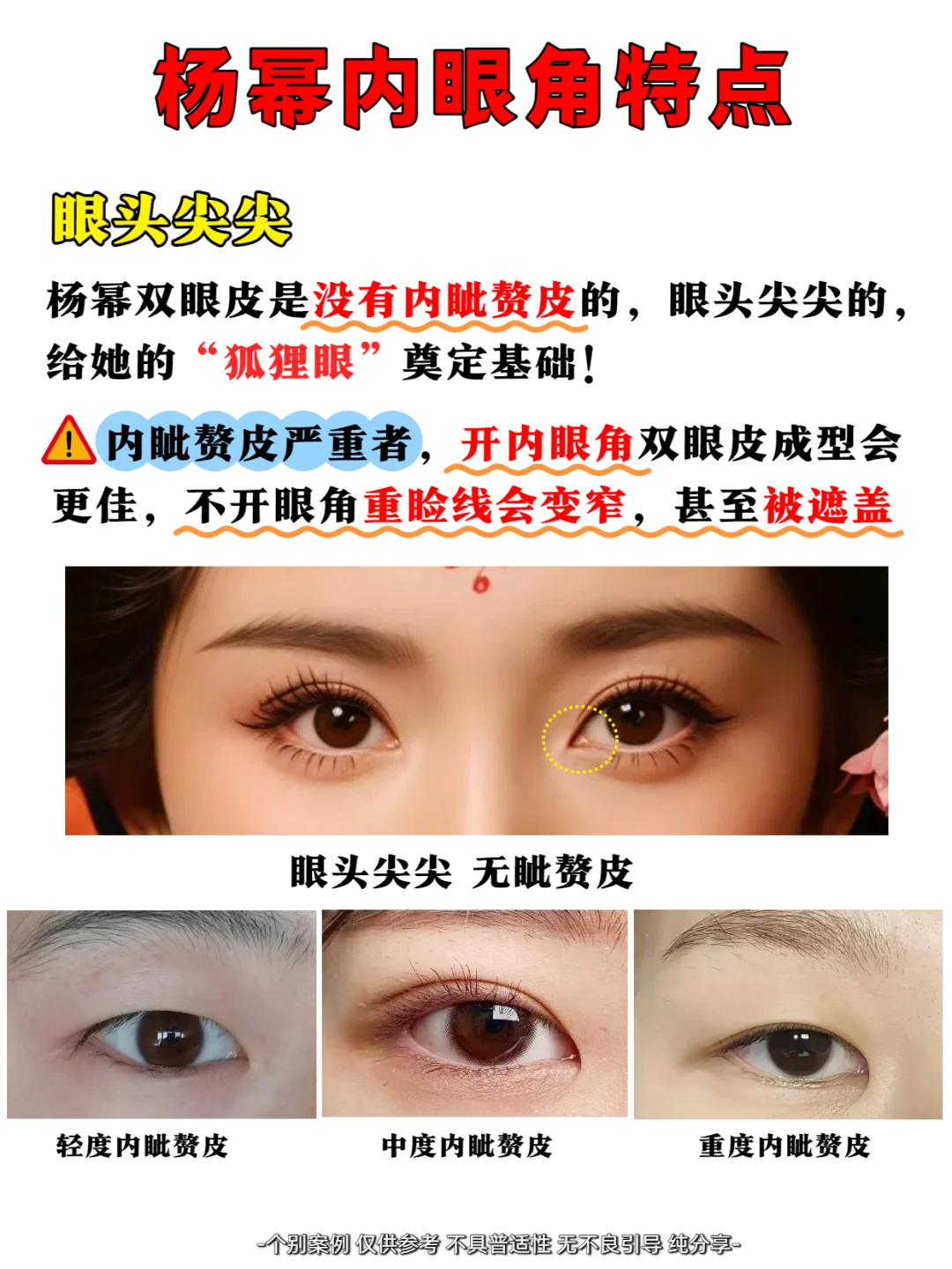 怎么没人拿杨幂的双眼皮当模板❓