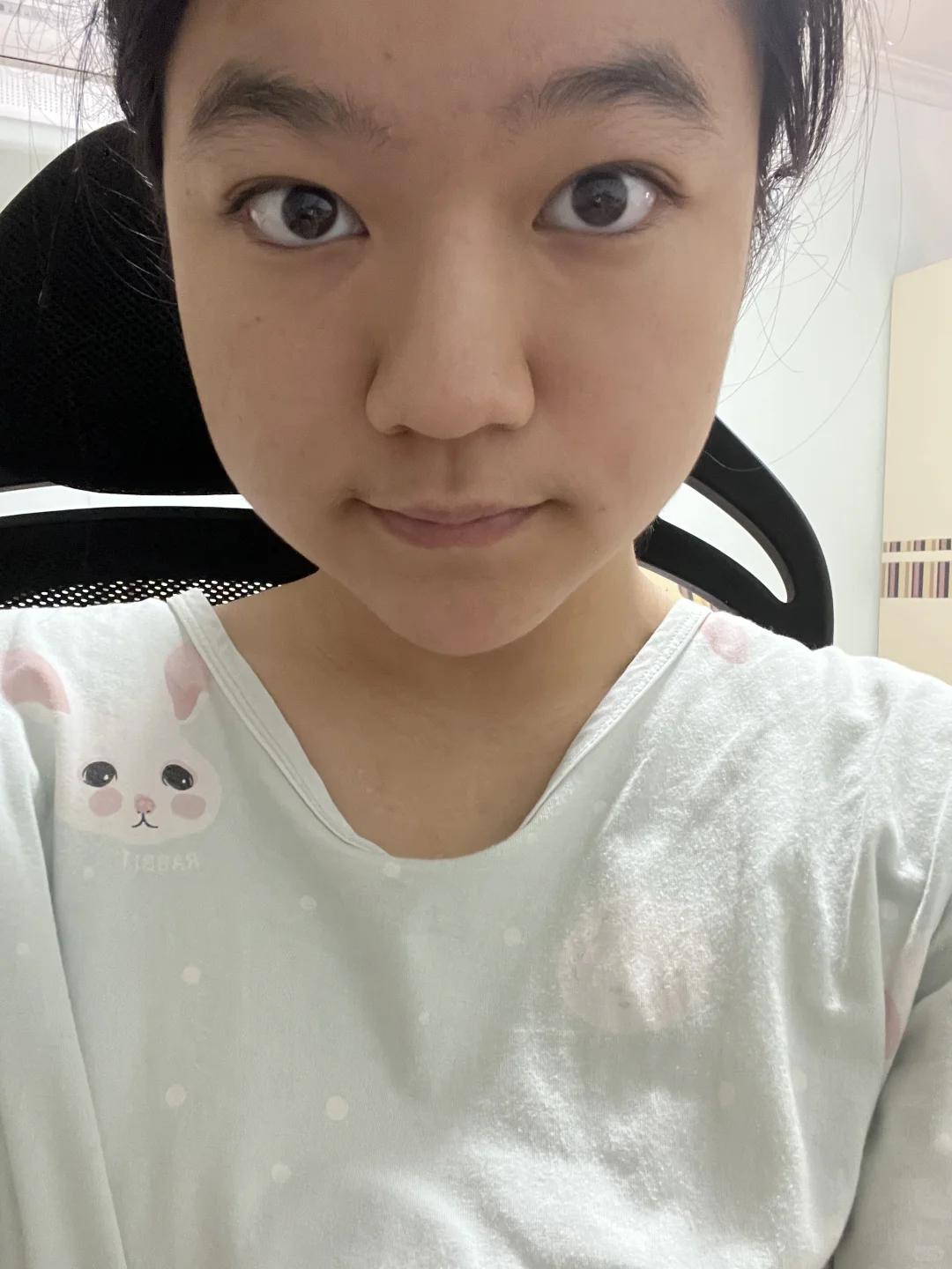 这种长相的变美正解是减肥吗🥺
