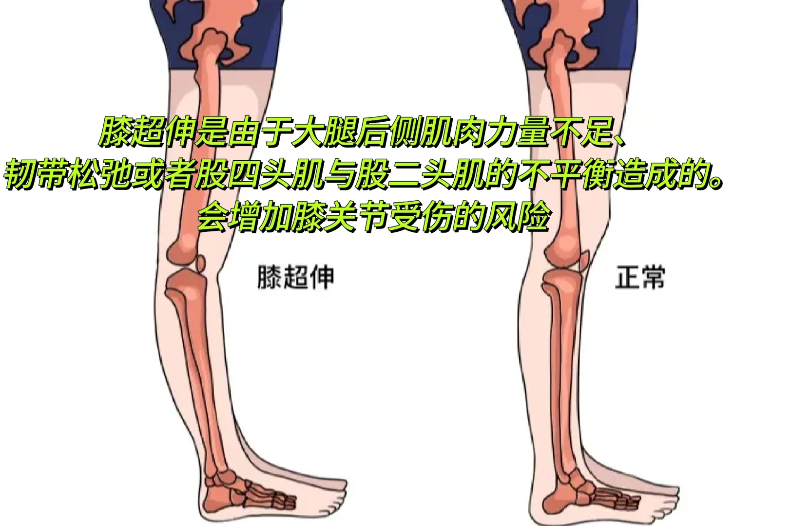 美人感体态1