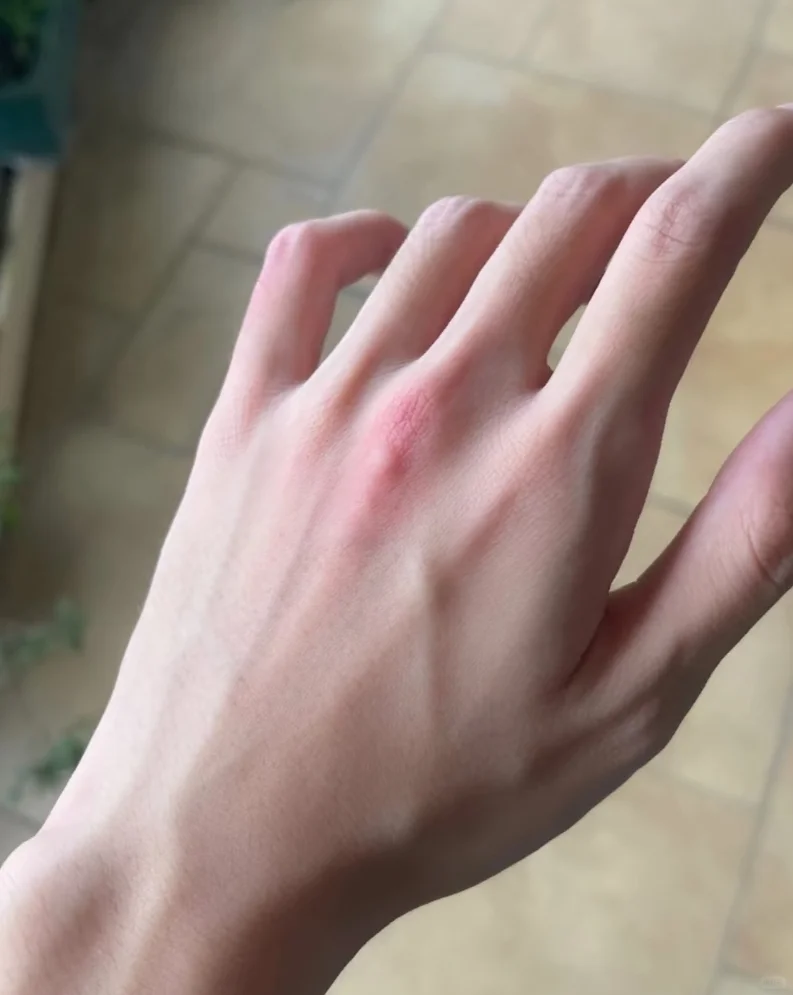 中医搂手撩妹，私聊全是撩手诊的