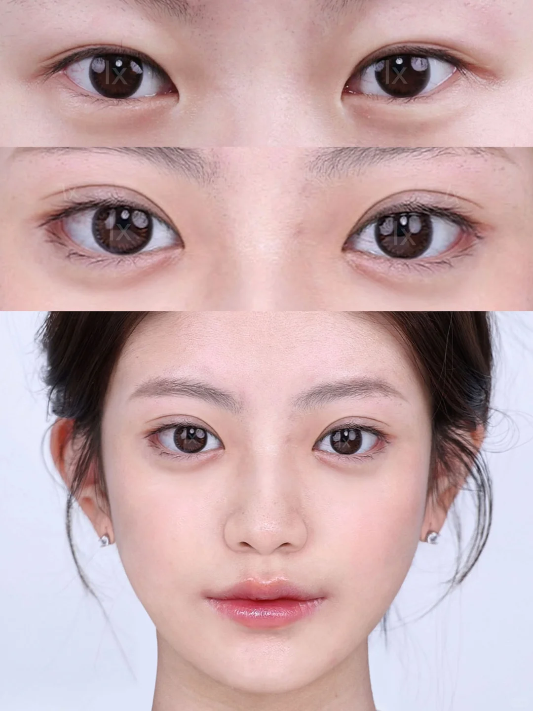深圳双眼皮|7mm 开扇钓系勾人眼~