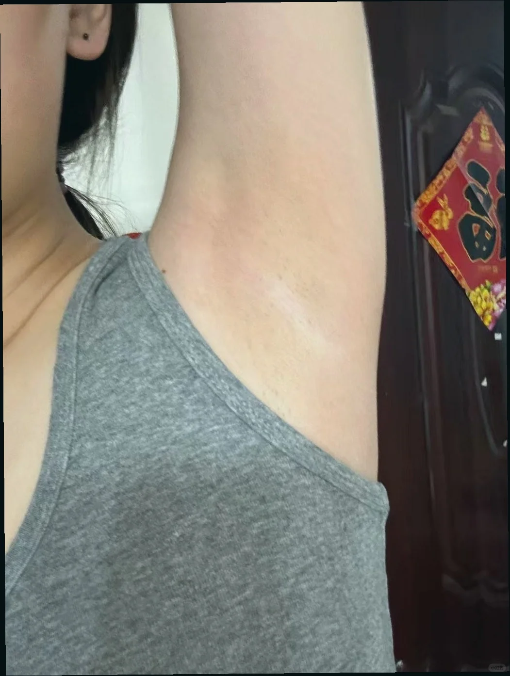 重要场合别被腋下黑毁了！婚纱比基尼都能穿