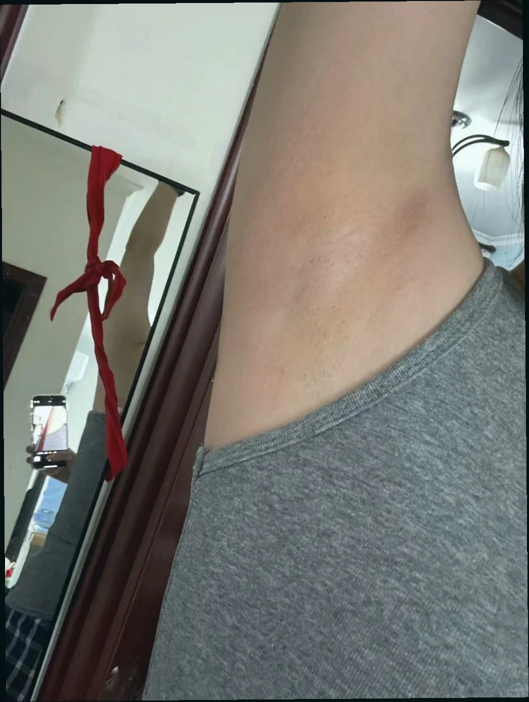 重要场合别被腋下黑毁了！婚纱比基尼都能穿